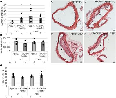 PACAP regulates VPAC1 expression inflammatory Frontiers